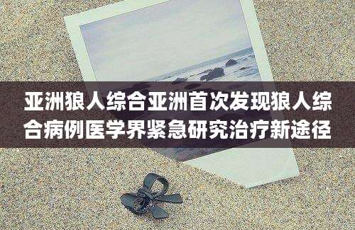 亚洲狼人综合亚洲首次发现狼人综合病例医学界紧急研究治疗新途径